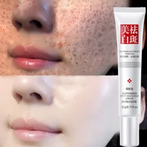 Menghilangkan Bintik-Bintik Hitam Melasma - BST